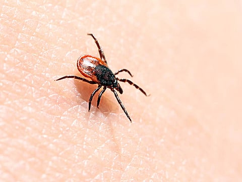 tick on a human skin