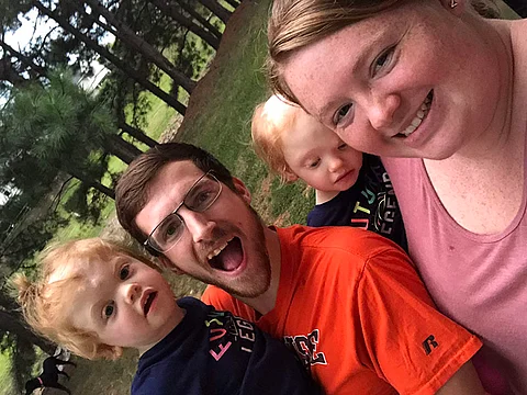 formerly conjoined twins after surgery