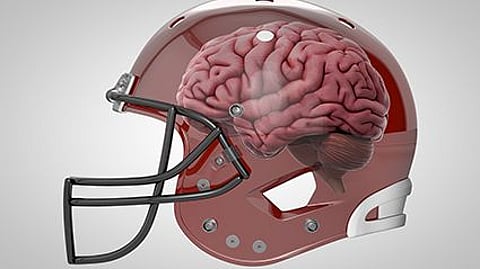 diagram of a brain in a helmet