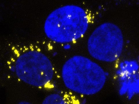 Brain cells infected with amyloid beta prions