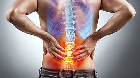 back pain picture