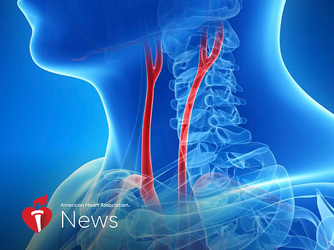 Treatment to Ward Off Stroke Less Effective in Women