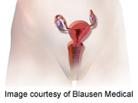 Most Ob-Gyns Still Perform Bimanual Exam But Reasons Vary