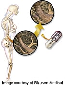 Hormone Replacement Therapy Initiated Early Deemed Safe