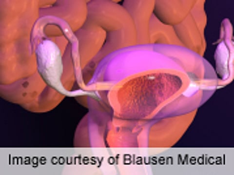 Young Age at Menarche Doesn't Equate to Earlier Sex