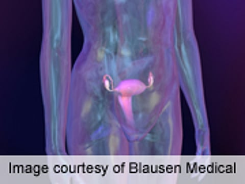 No Overall Survival Benefit Tied to Bilateral Oophorectomy