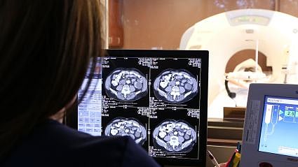 Breast Cancer Scans