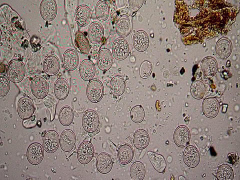 Microscopic grass pollen
