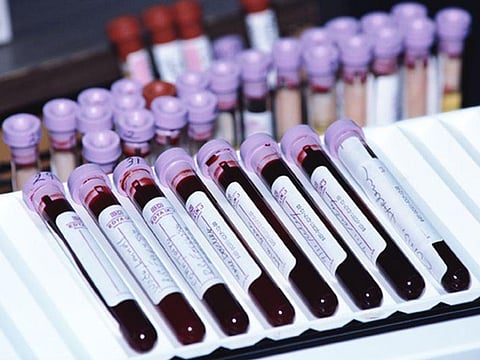 blood samples