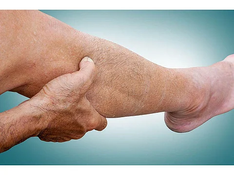 leg cramp