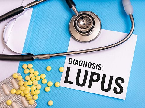 lupus