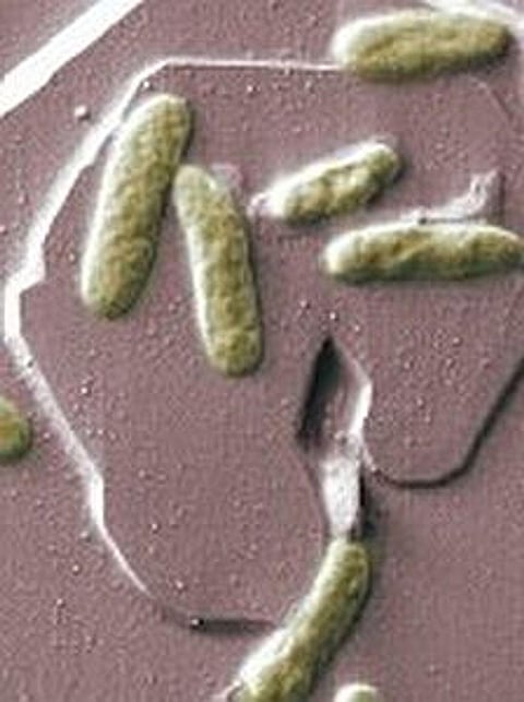 Encuentran el cuarto caso de una enfermedad bacteriana tropical en EE. UU.: CDC