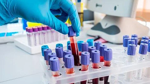 blood samples blood