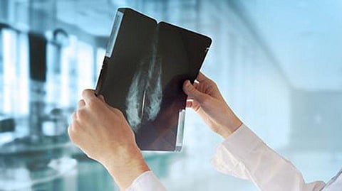 Women With Very Early Breast Cancer May Safely Skip Radiation Rx: Study