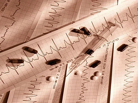 heart scan