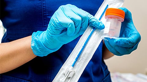 ¿Podría una prueba de Papanicolaou ayudar también a detectar los cánceres de mama y de ovario?