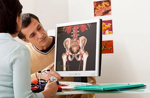 iliac vein