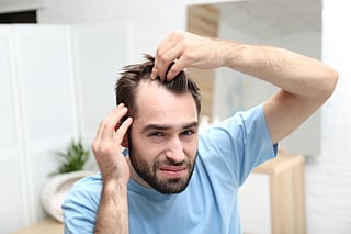 Young man with hair loss problem indoors