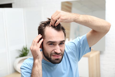 Young man with hair loss problem indoors