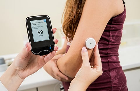 Medical device for glucose check. Continuous glucose monitoring pod. Modern wireless technology.