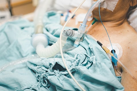 Patient do tracheostomy and ventilator in hospital