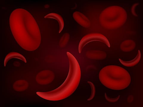 FDA Advisors Say New Gene Therapy for Sickle Cell Disease Is Safe