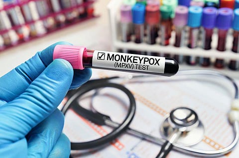 monkeypox test