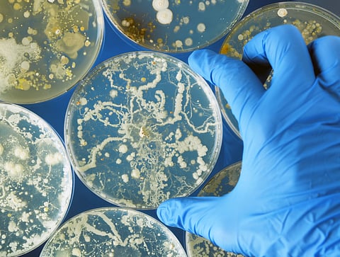 fungus fungal