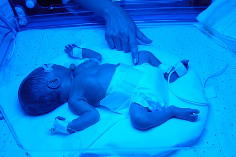 premature birth, preemie in the NICU