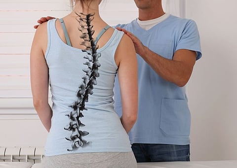 scoliosis