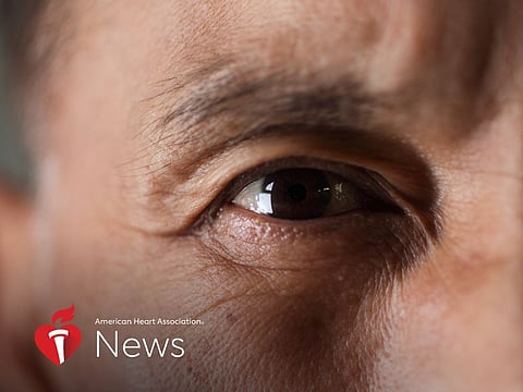 AHA News: The Brain Isn't the Only Place a Stroke Can Occur