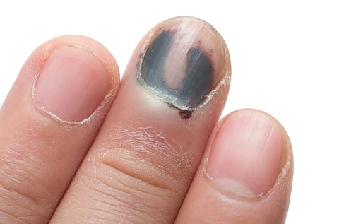 fingernail nail