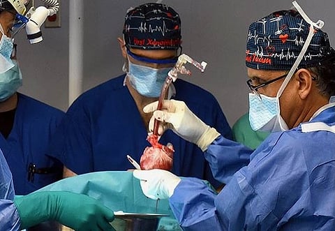 UMPigtransplant