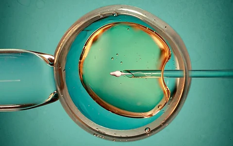 Fecundación in vitro