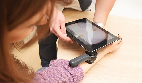 AI Getting Better at Detecting Skin Cancer