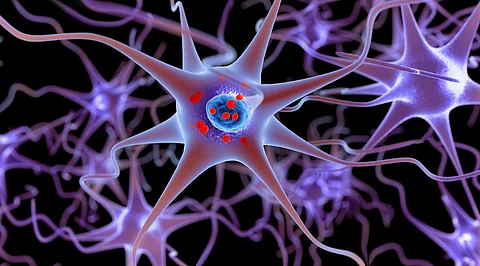 Cardiac 18F-Dopamine PET Can Predict Lewy Body Diseases