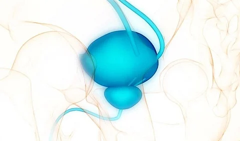 Risk for Benign Prostatic Hyperplasia Increased for Patients With Gout