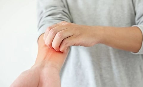 Climatic Hazards Linked to Aggravation of Atopic Dermatitis