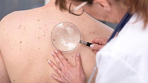 Gender Minority Adults Are Vulnerable During Full Body Skin Exam