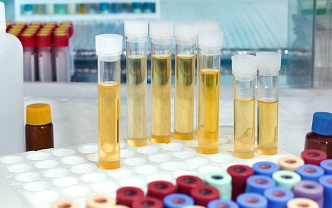 Clinician Decision Support Can Reduce Unspecified Testing in Primary Care