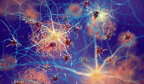 Reduced Levels of CSF β-Amyloid Seen in Veterans With Blast-Related mTBI