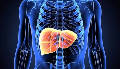 GLP-1 RA Reduces Severity of Steatotic Liver Disease in People With HIV