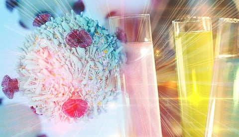 Second Primary Malignancies Represent Small Proportion of Adverse Events After CAR T-Cell Therapy