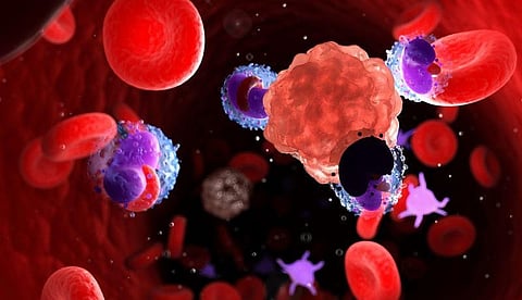 Survival 21 Percent a Year After ICU Discharge for Blood Cancer Patients