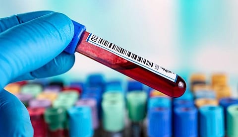 Serum Biomarkers Predict Knee OA Before Radiographic Abnormalities