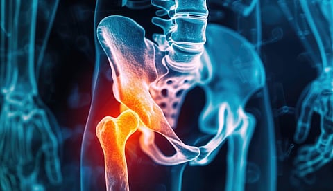 Progressive Resistance Training Not Superior for Hip Osteoarthritis
