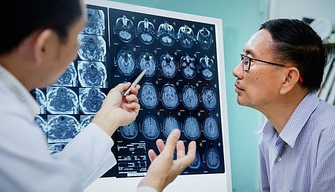 Silent Brain Infarct, Cerebral Small Vessel Disease Prevalent in Heart Disease
