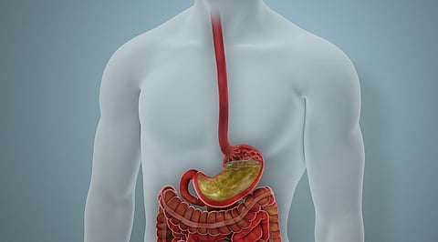 digestion stomach Barrett esophagus