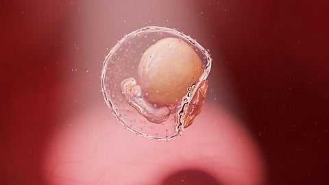 High Level of Approval Observed for Polygenic Embryo Screening