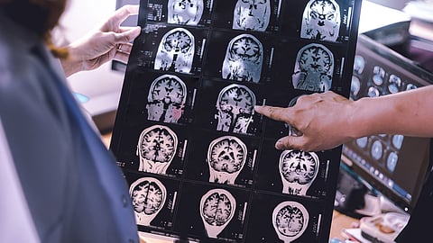 brain scans